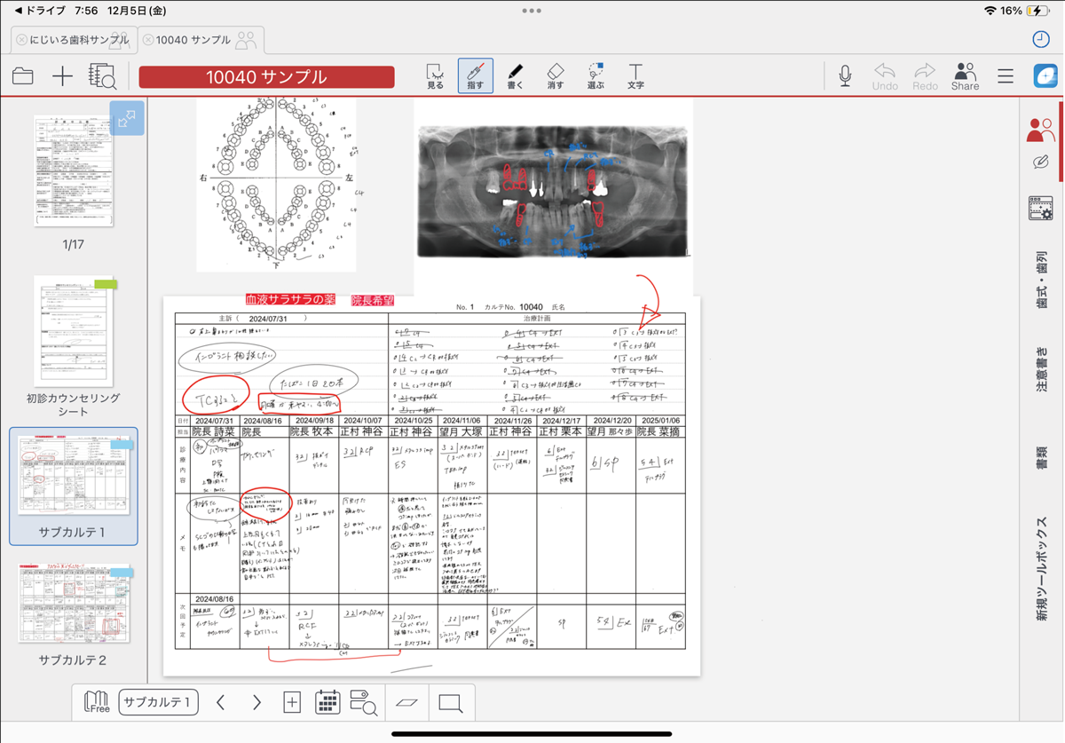 サブカルテ1利用例